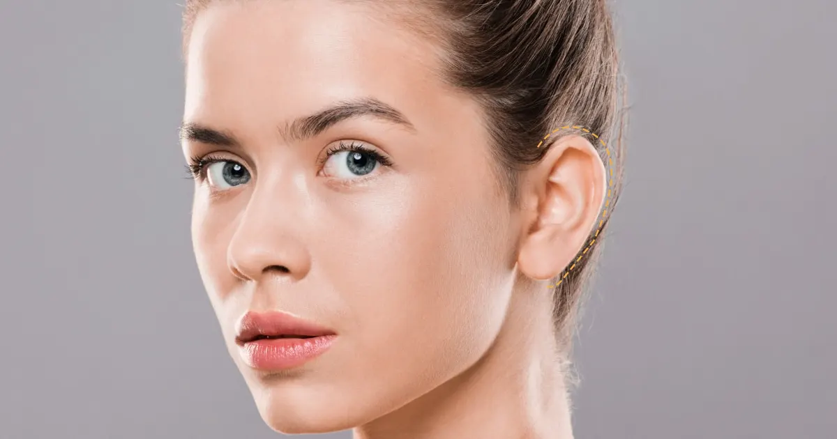 Correction des oreilles décollées et réduction des oreilles