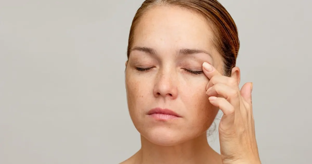 la blepharoplastie