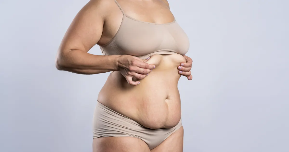 signes abdominoplastie