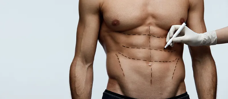 Abdominal Etching Tunisie