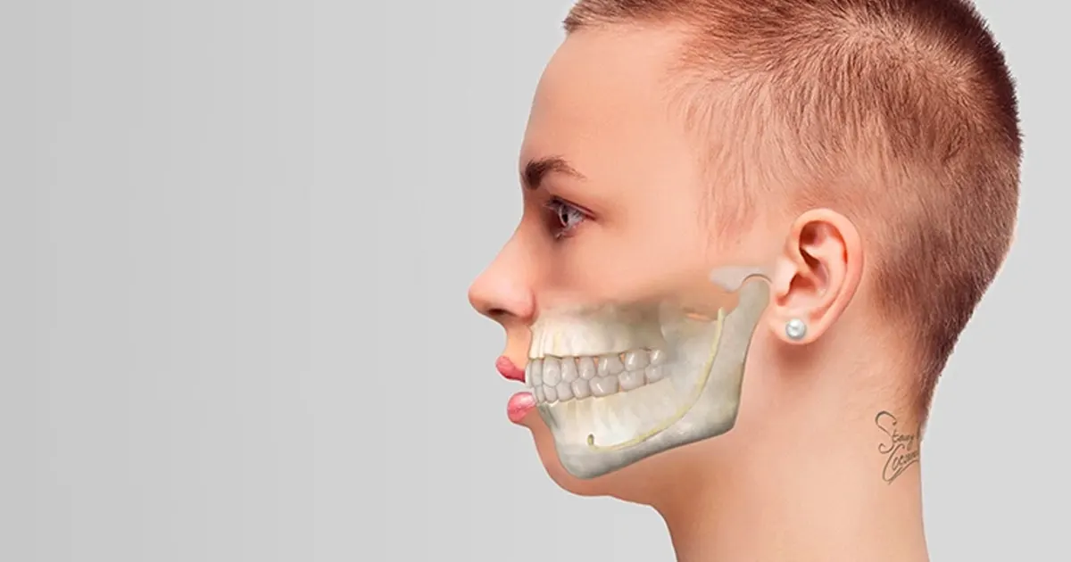 prix genioplastie tunisie