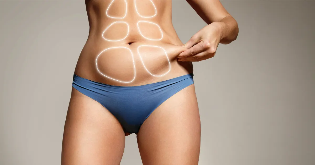 Liposuccion et harmonisation de la silhouette