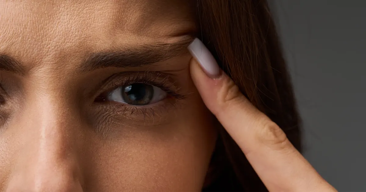 blépharoplastie